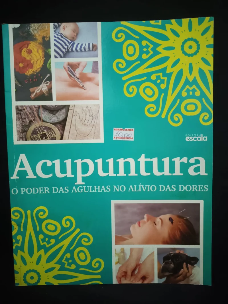 Acupuntura